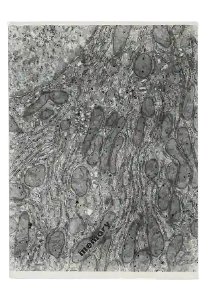 MEMORY (HISTOLOGICAL POEM). 1972