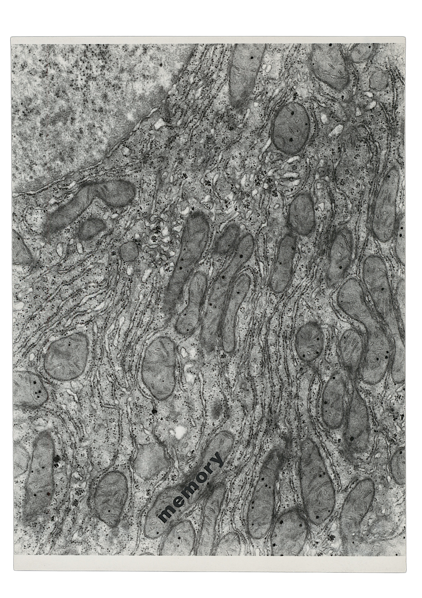 memory (Histological Poem).