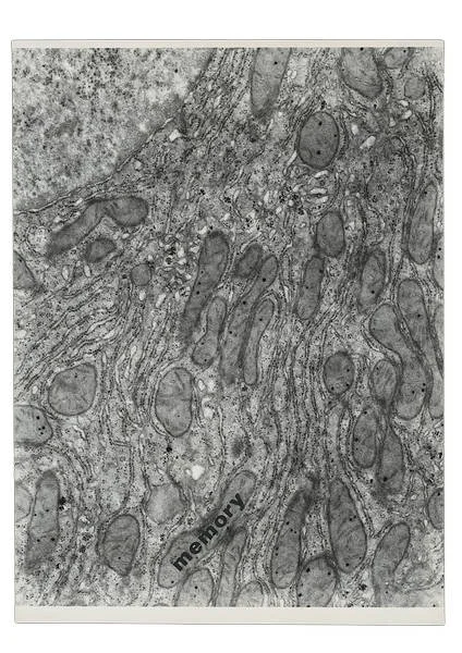 MEMORY (HISTOLOGICAL POEM). 1972