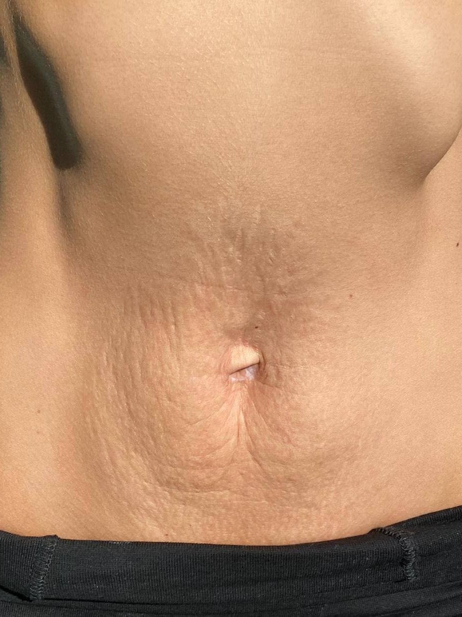After Image 5