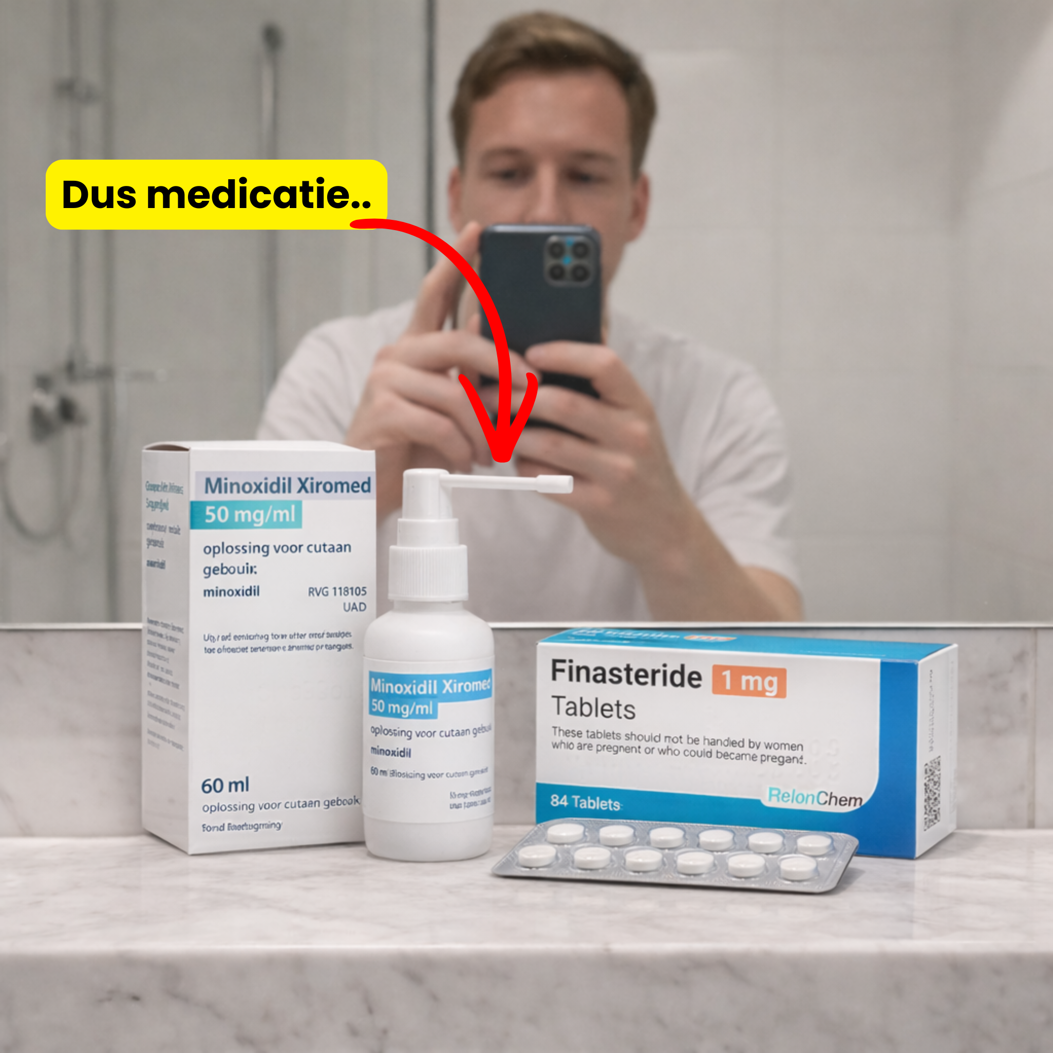 Neem Finasteride of accepteer het