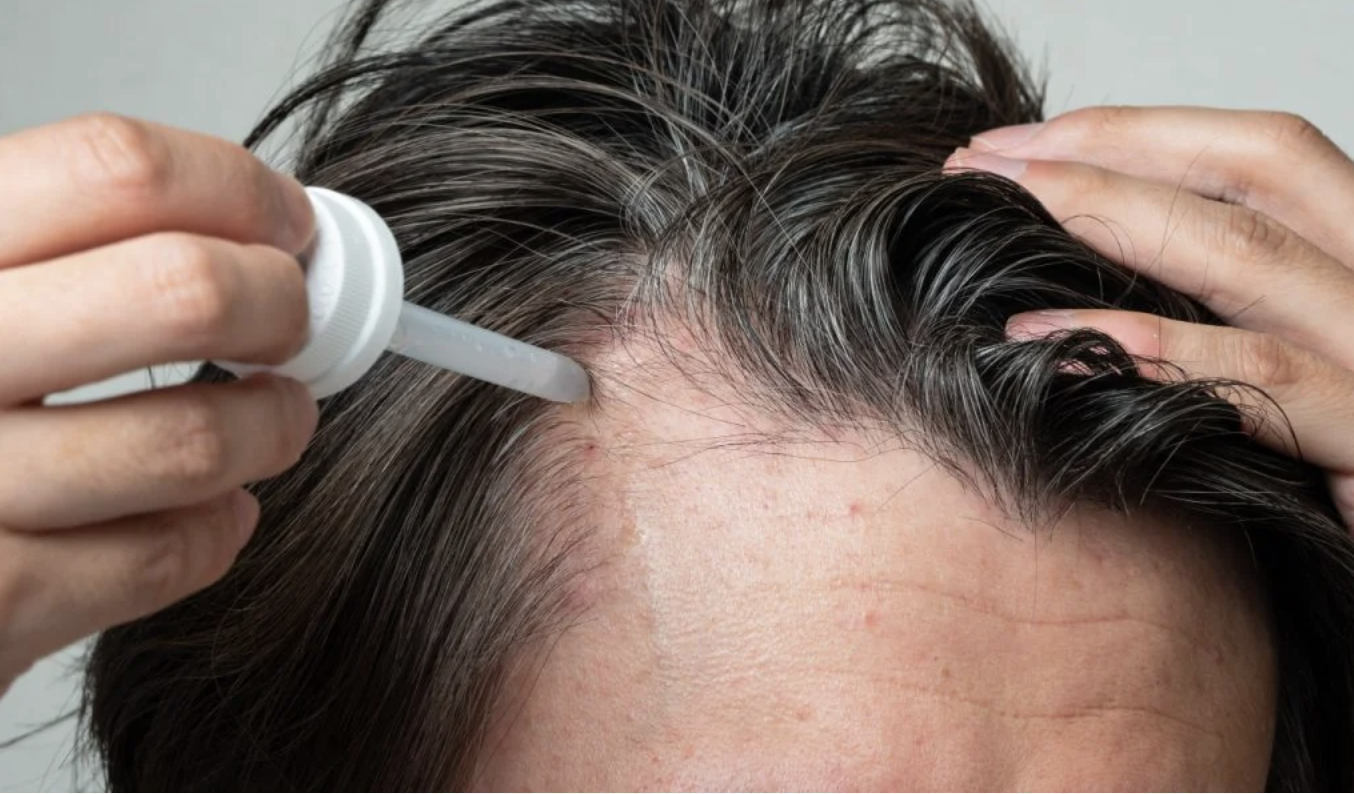 Haargroei serums vergelijking 2026