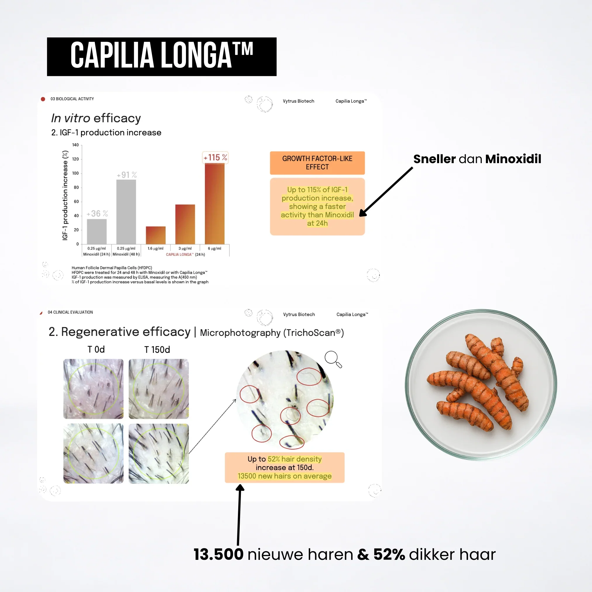 Capilia Longa™ klinische resultaten — +13.500 nieuwe haren in 150 dagen