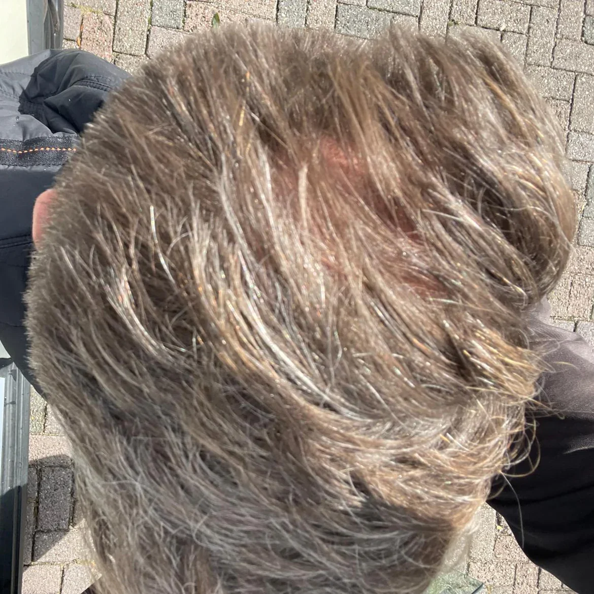 Na gebruik KÁDESO — zichtbare haargroei