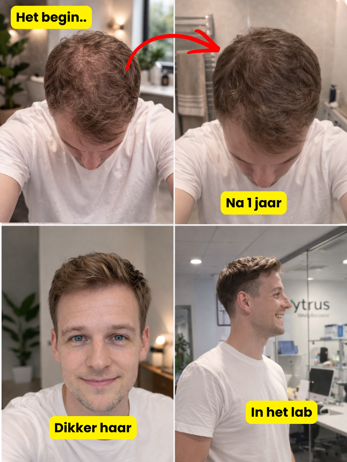 Haargroei resultaten vergelijking