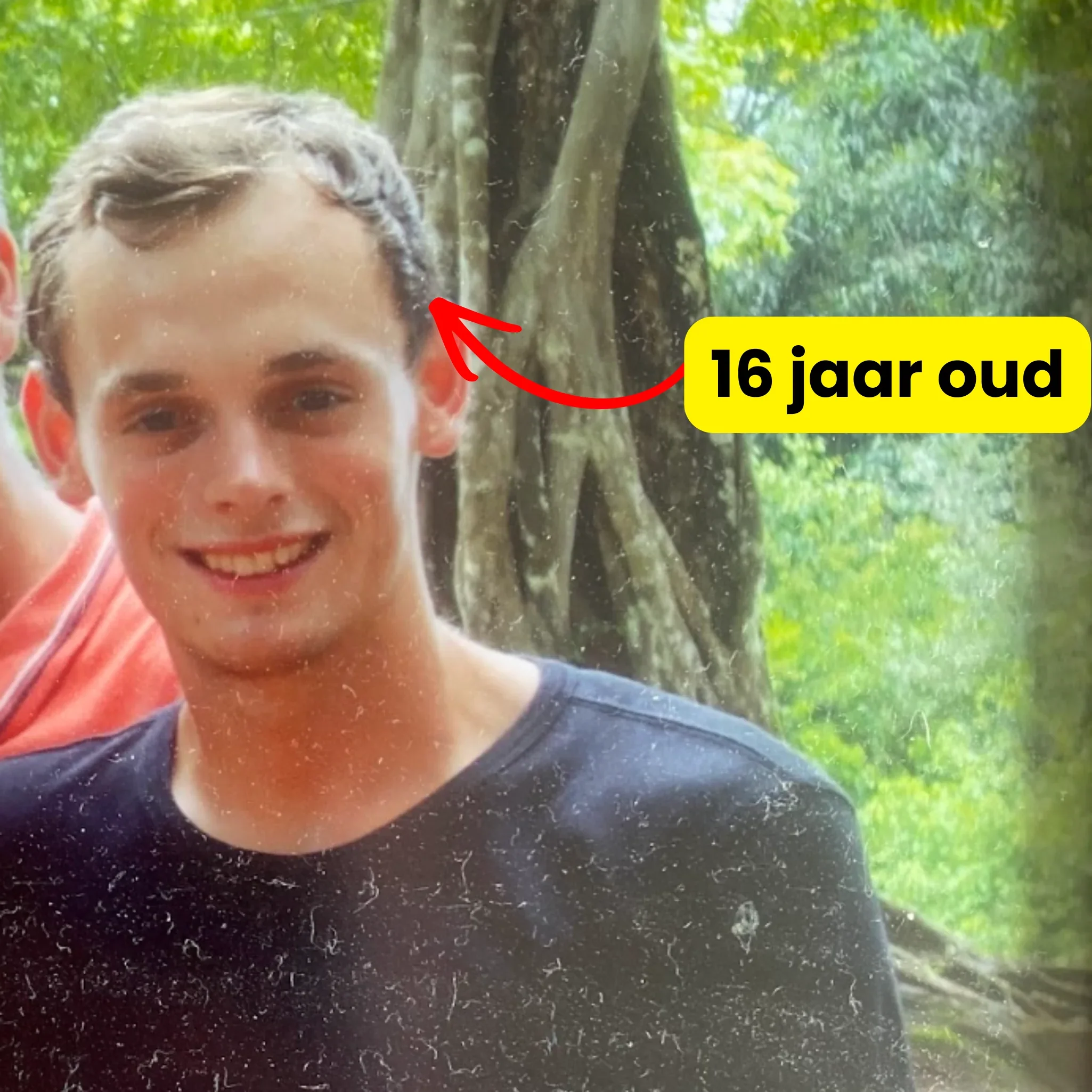 Casper, oprichter van KÁDESO — zijn strijd tegen haaruitval