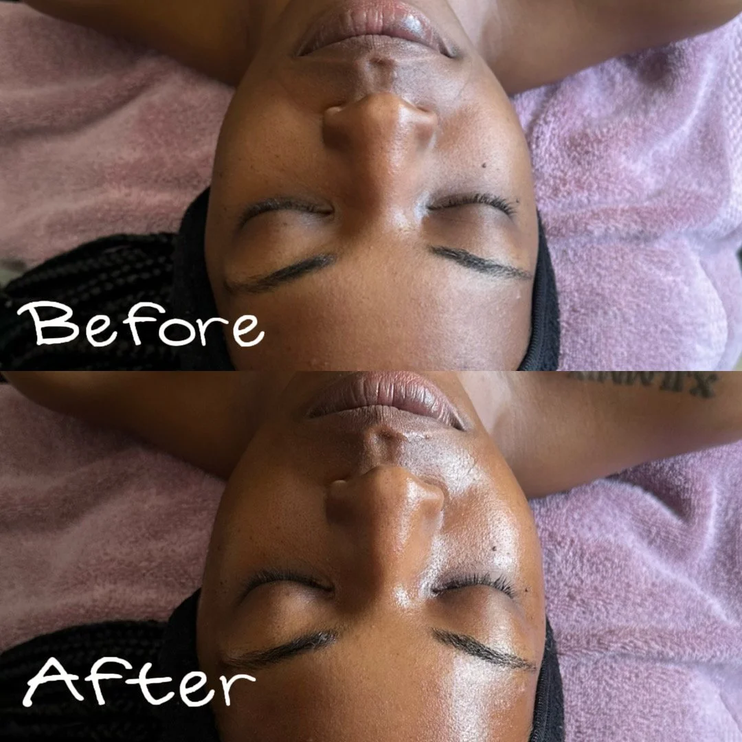 Facial before and after