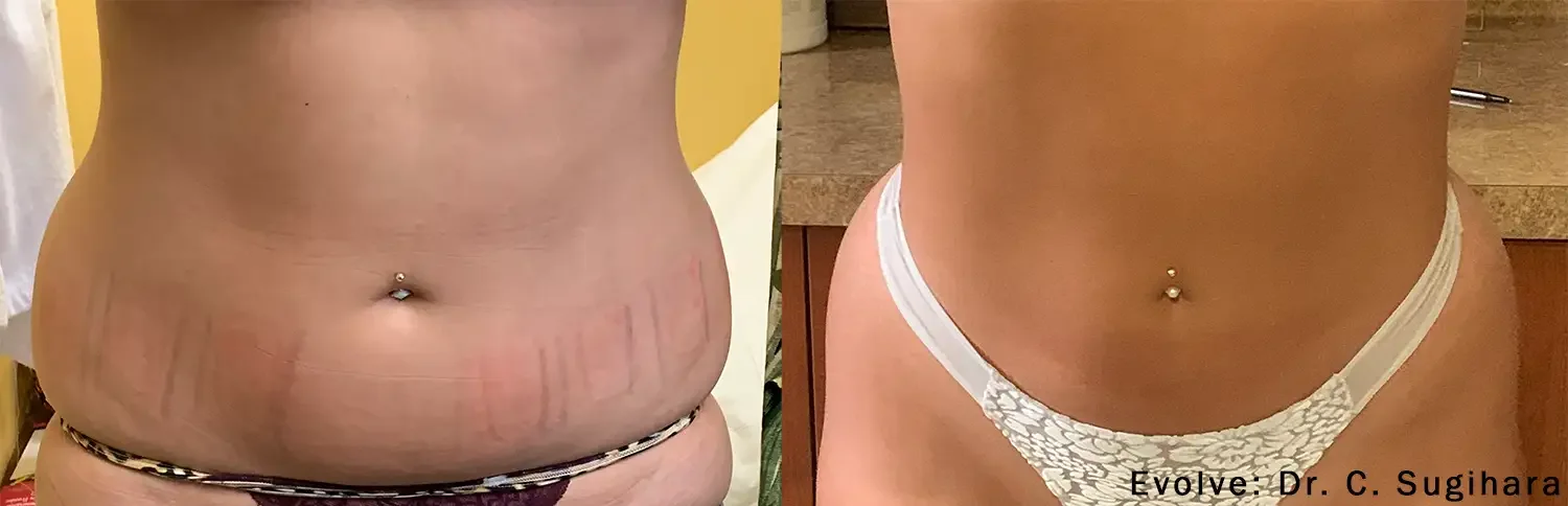 Evolve before and after