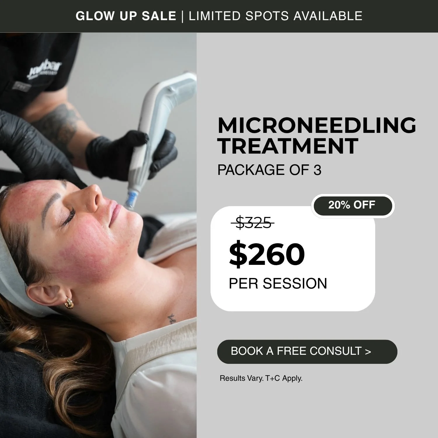 Microneedling Treatment, package of 3, 20% off, $260 per session