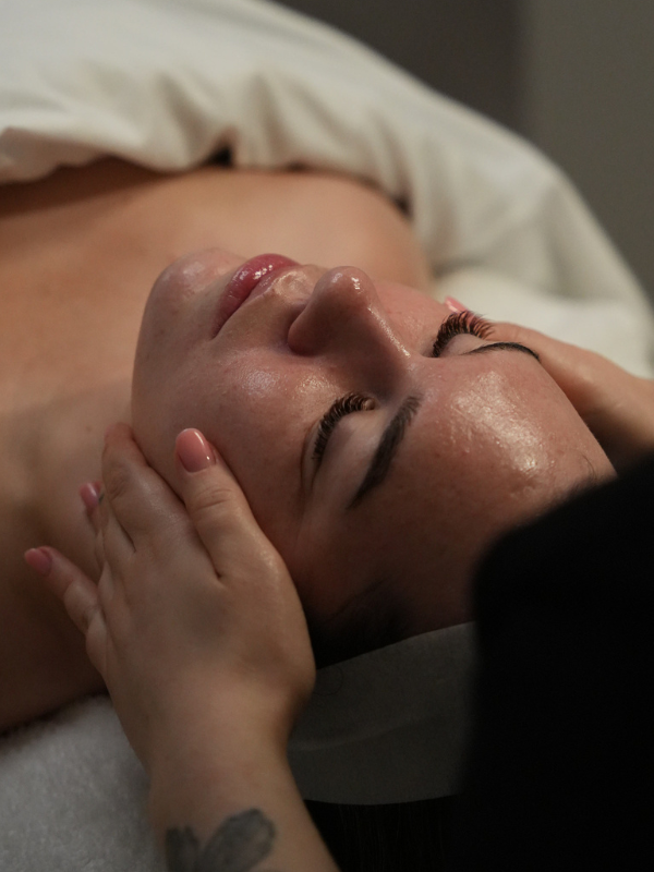 Chemical Peels