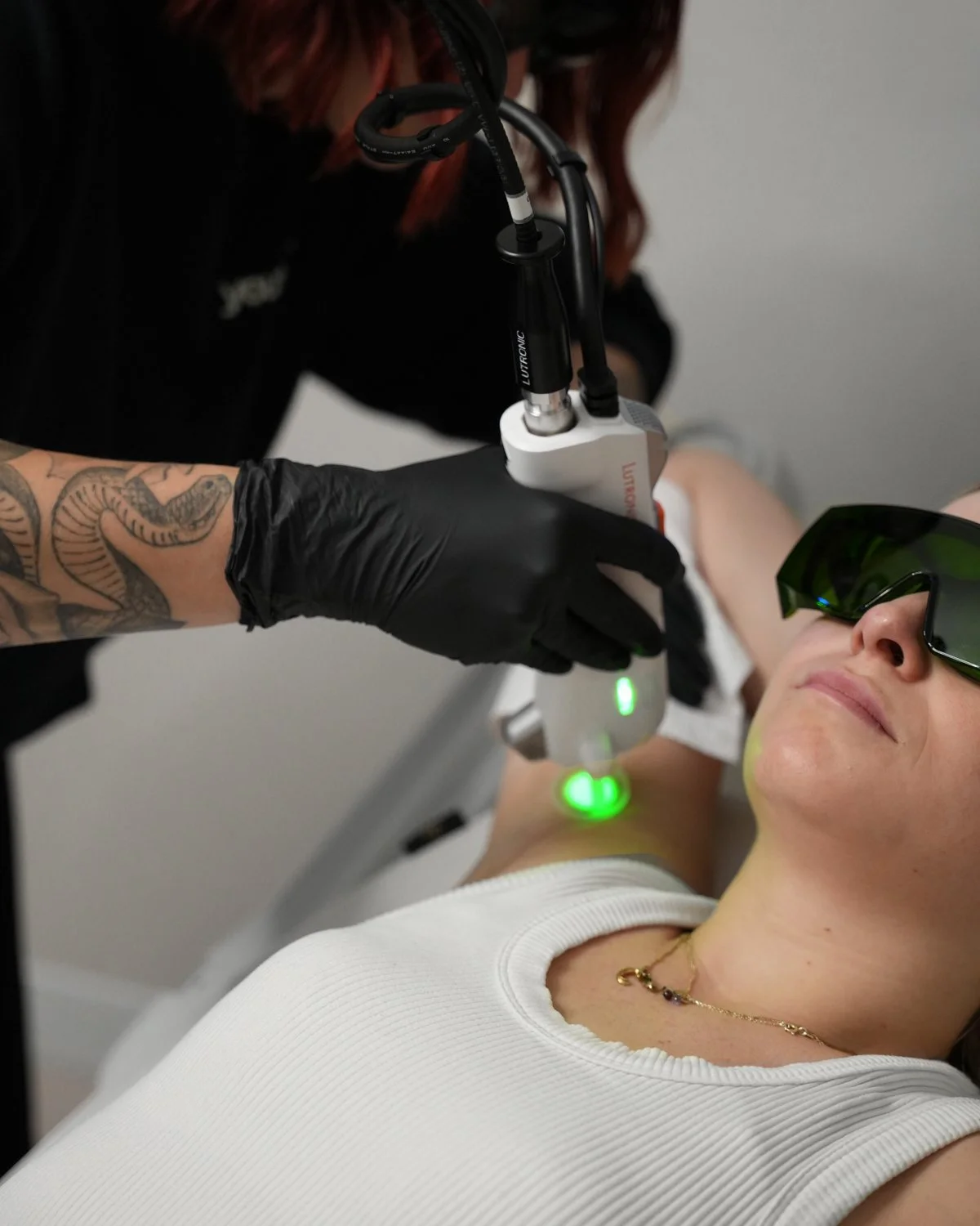 Underarm laser hair removal treatment with protective eyewear at Youth Bar.