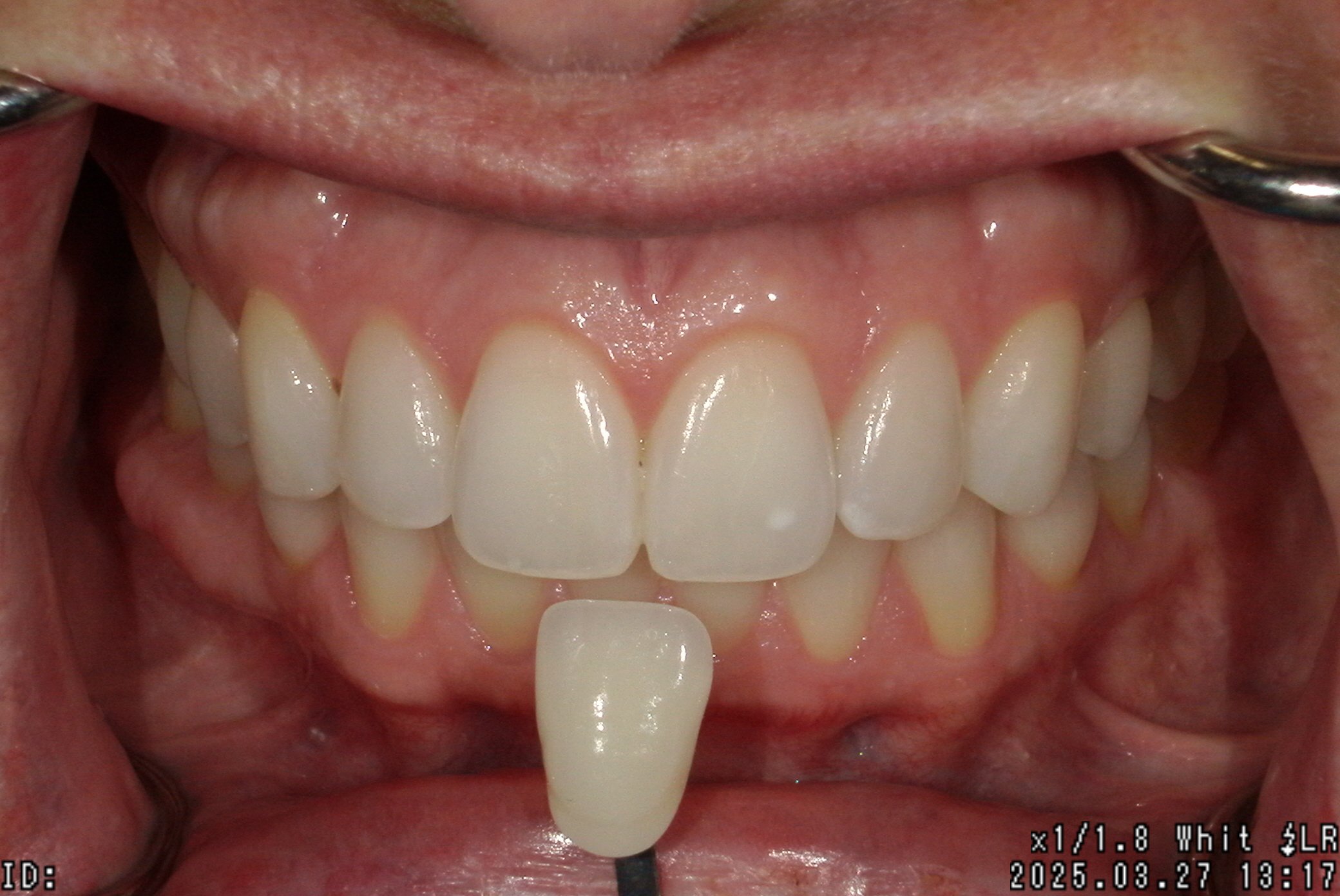 Before Image