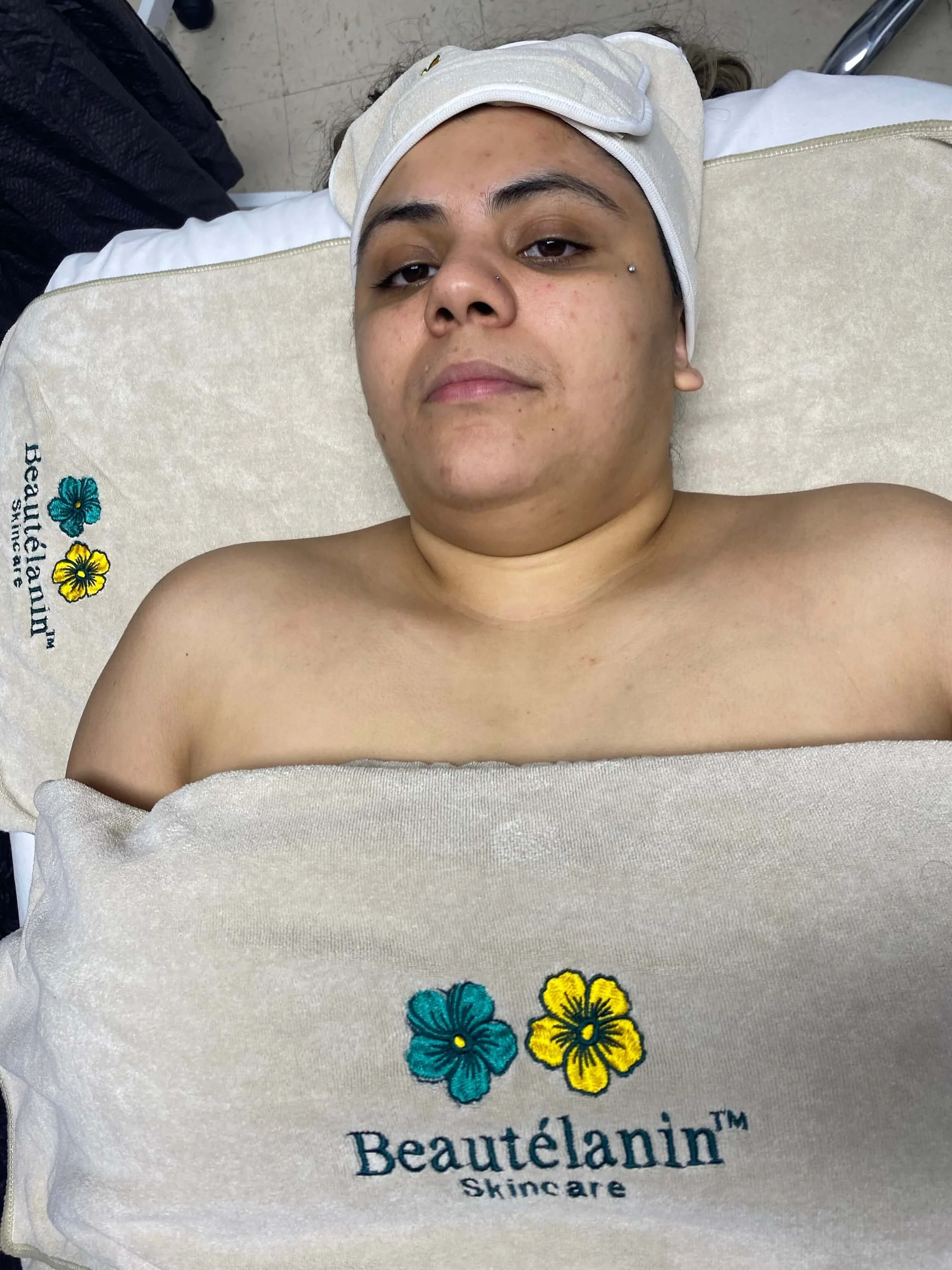 Catherine — before treatment