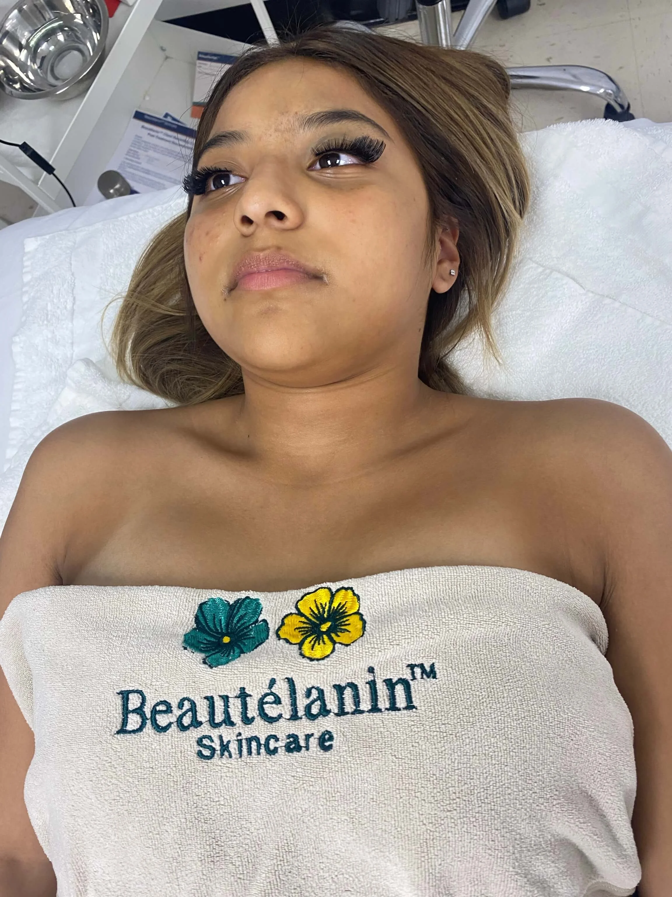 Emily — during restorative facial