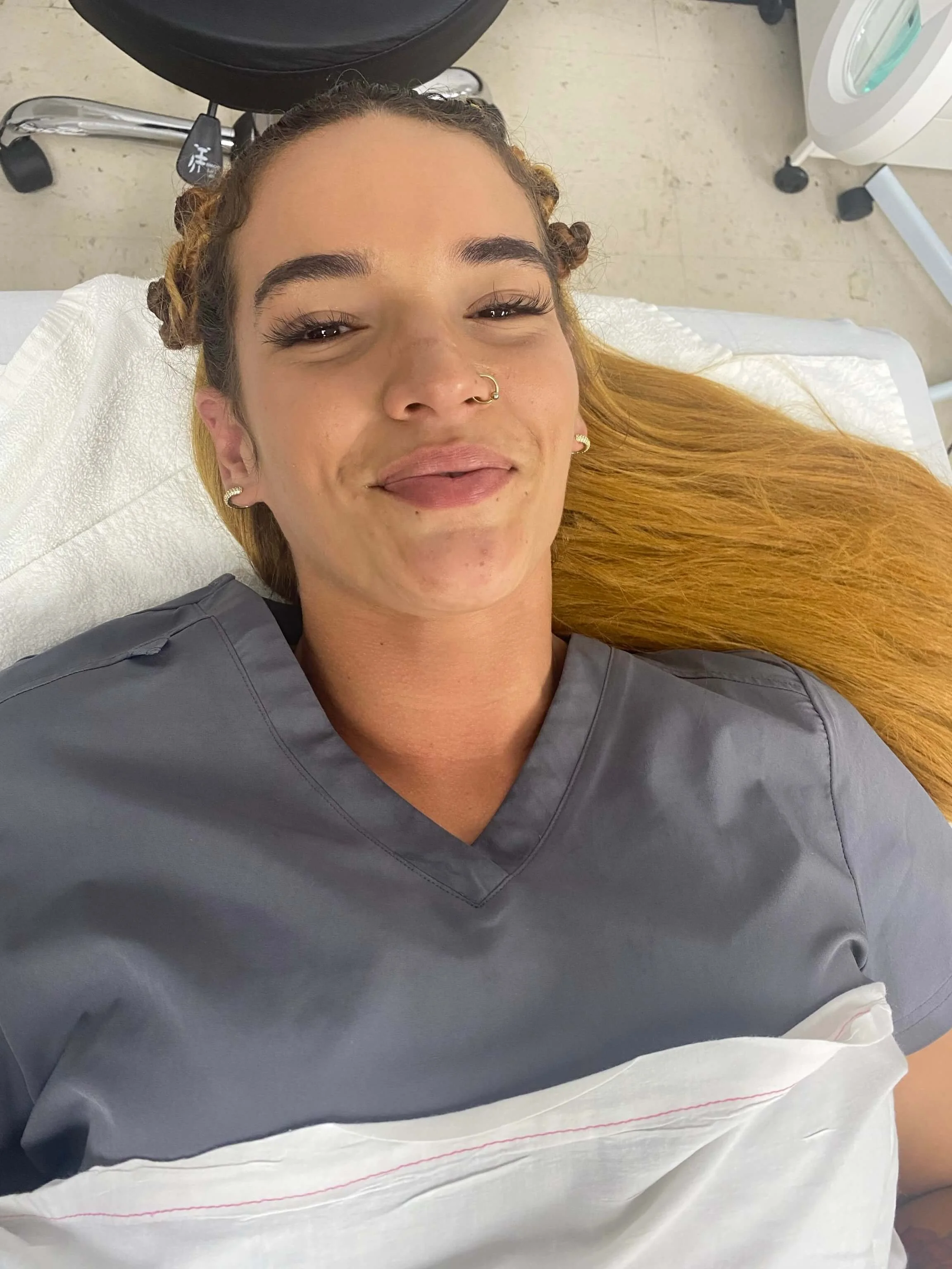 Emily — post-breakout recovery, before