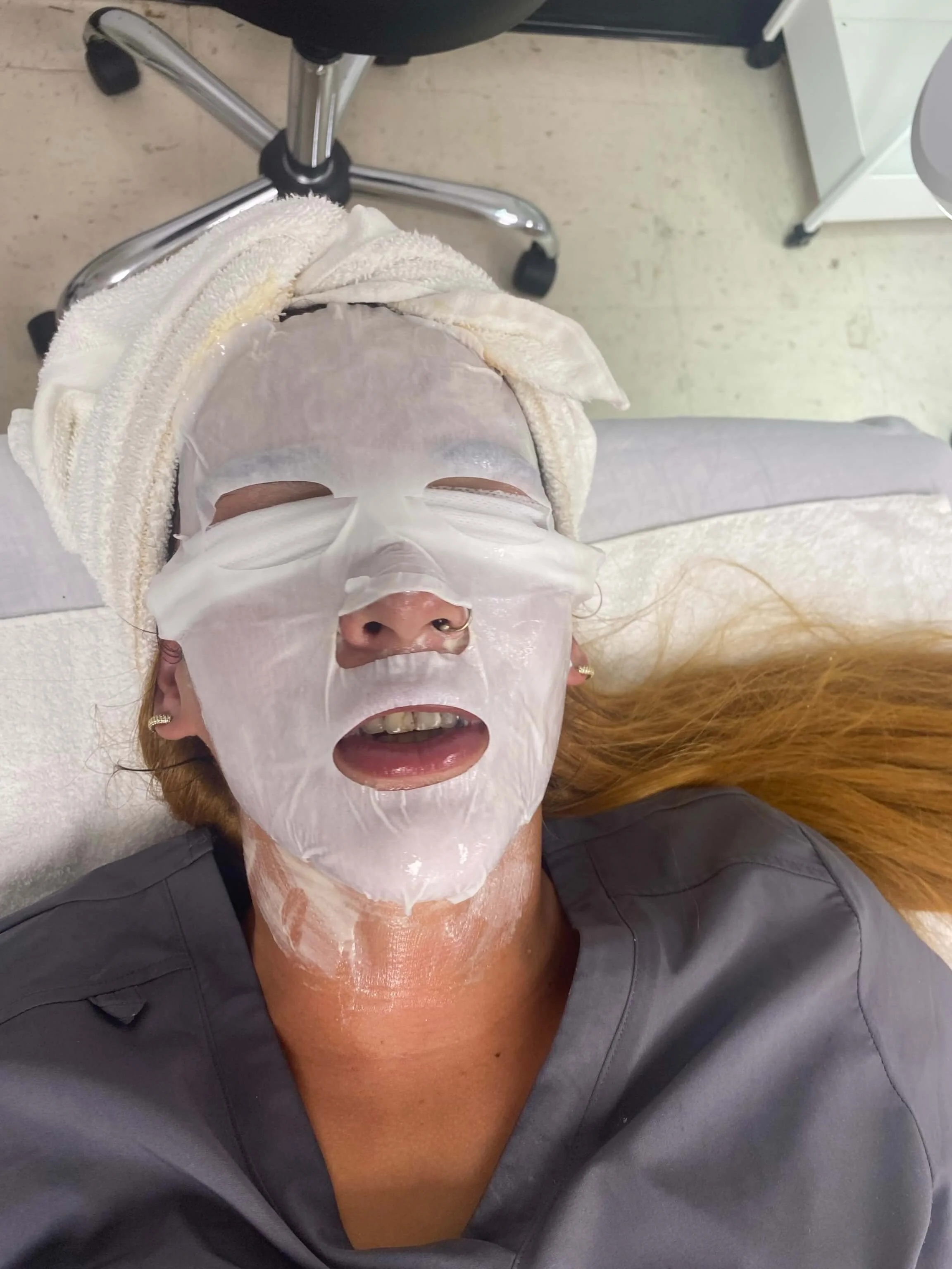 Emily — during treatment