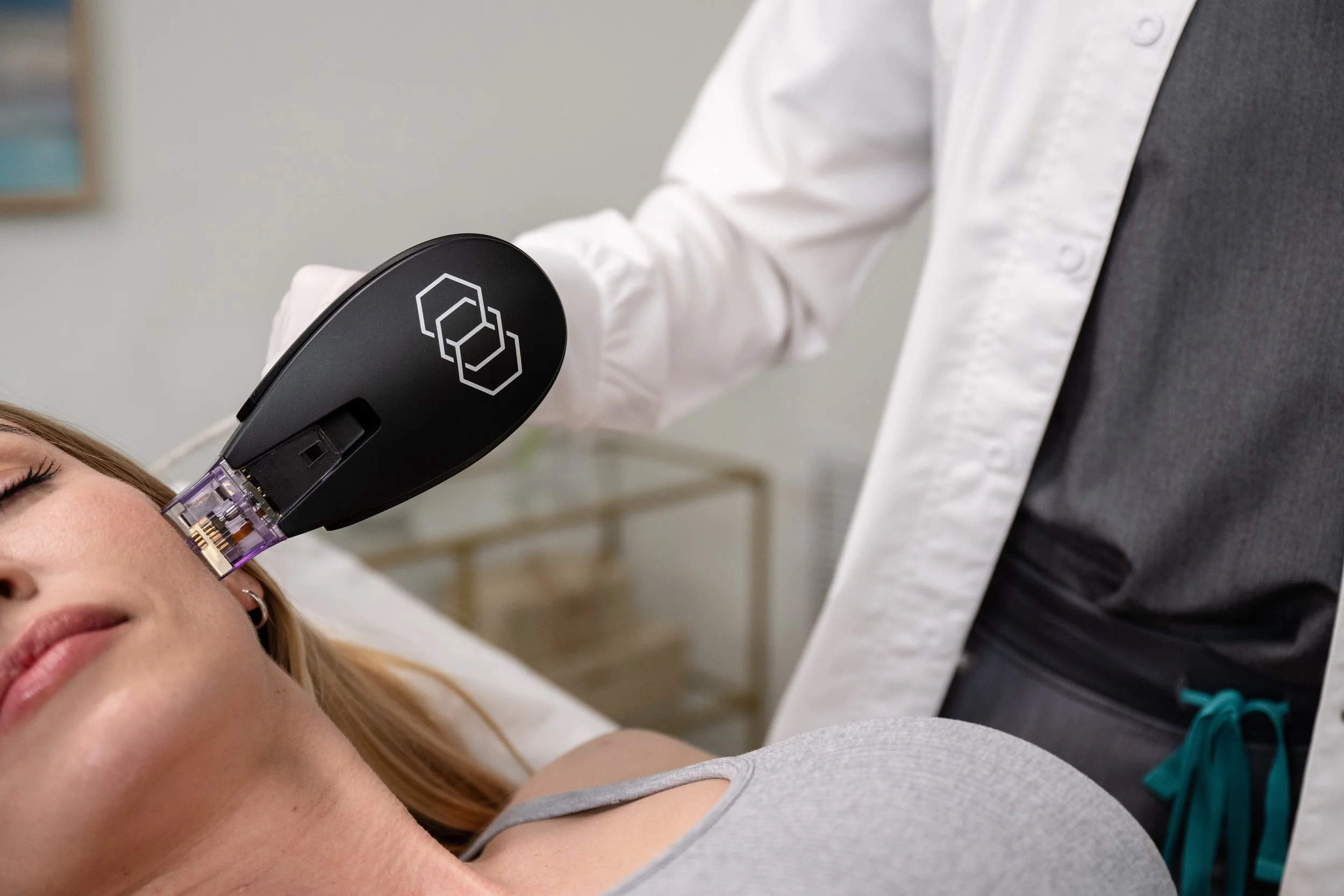 Morpheus8 treatment device at Hush Lasers and Aesthetics