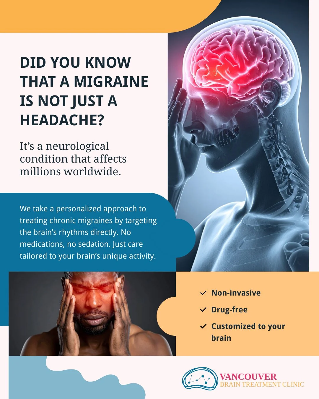 Infographic explaining that migraine is a neurological condition treated with personalized PrTMS therapy at Vancouver Brain Treatment Clinic