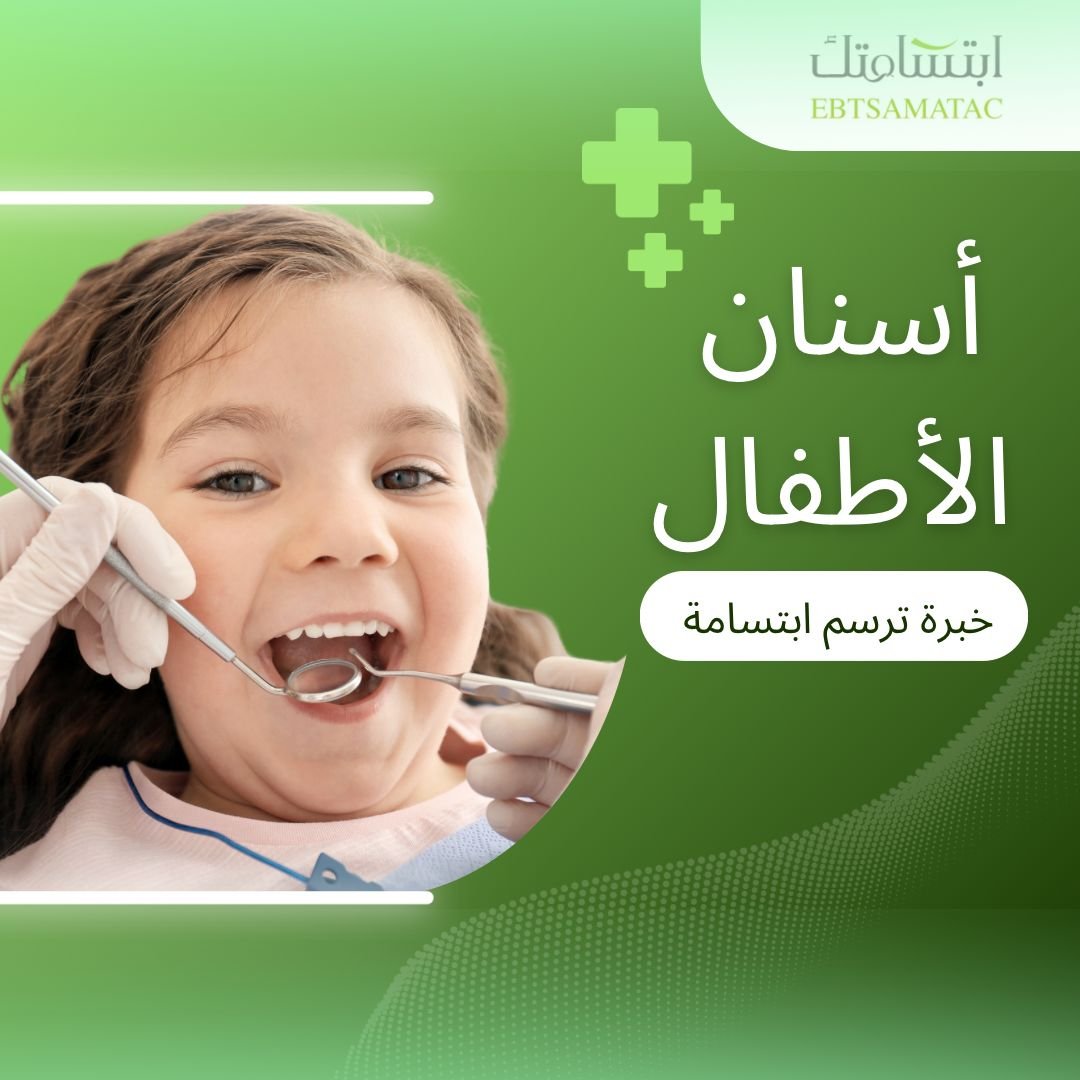 الأطفال