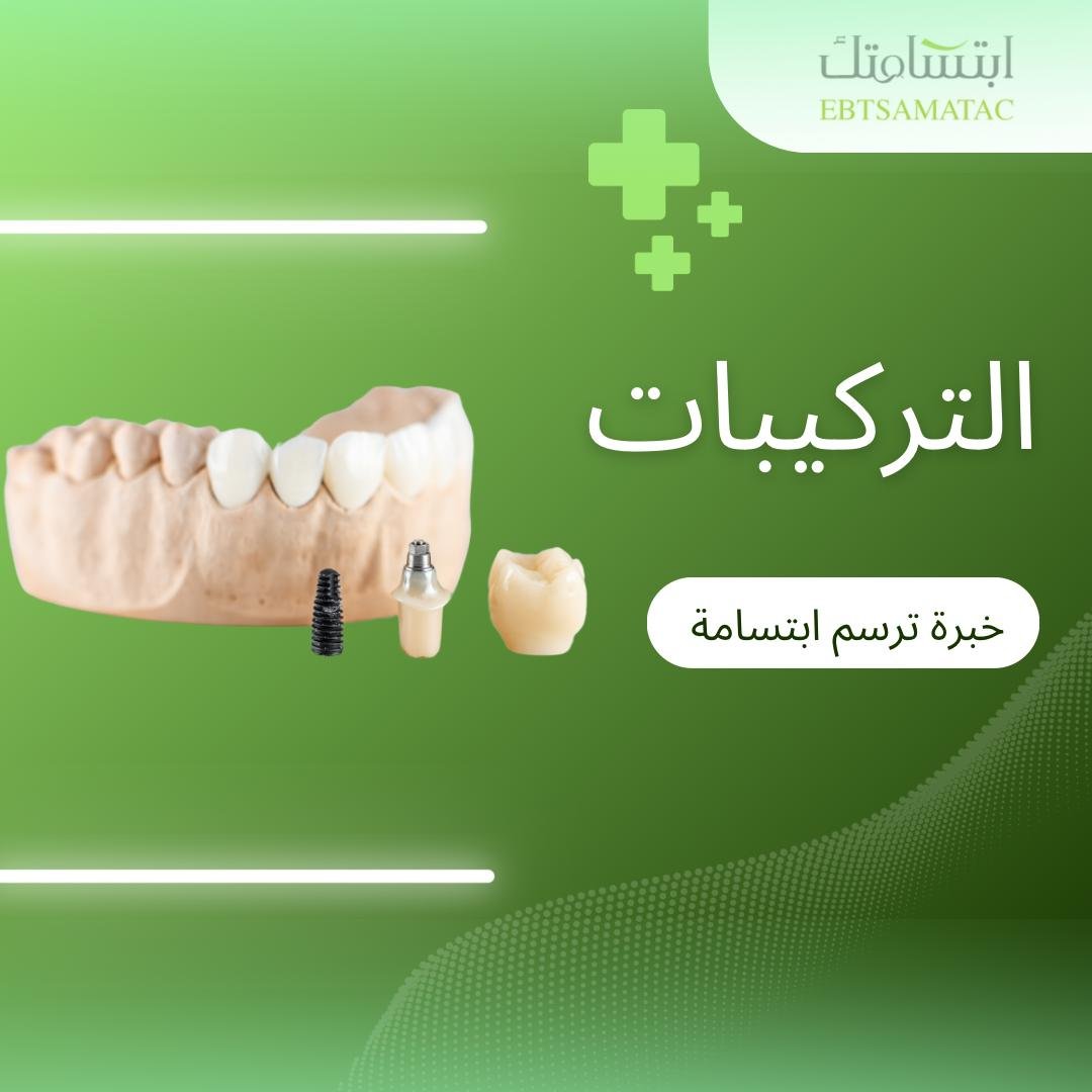 التركيبات