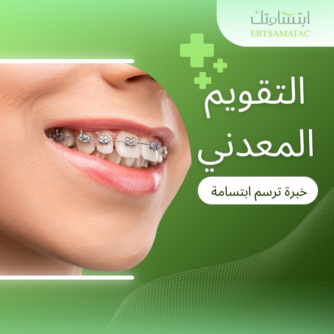 نقدم تقويمات شفافة ومعدنية تناسب جميع الأعمار لتحسين الابتسامة وتصحيح ترتيب الأسنان بدقة.