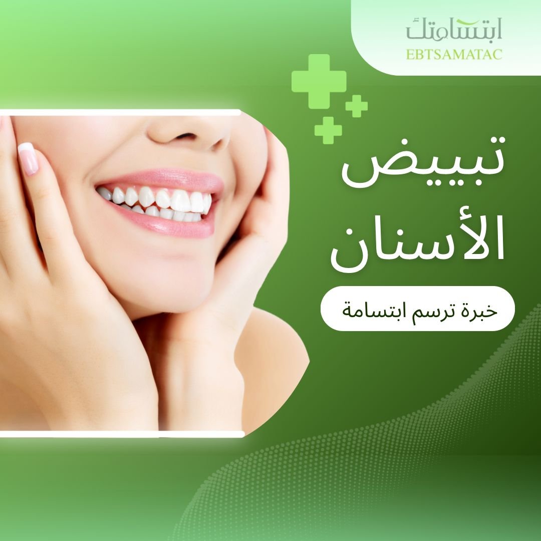 احصل على ابتسامة مشرقة بأحدث تقنيات تبييض الأسنان في مجمع ابتسامتك الطبي، بأمان وفعالية عالية على يد مختصين
