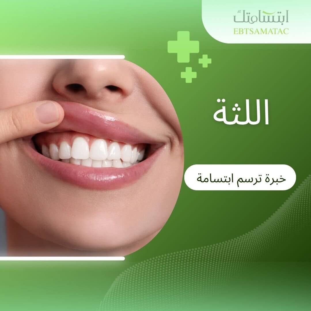 اللثة