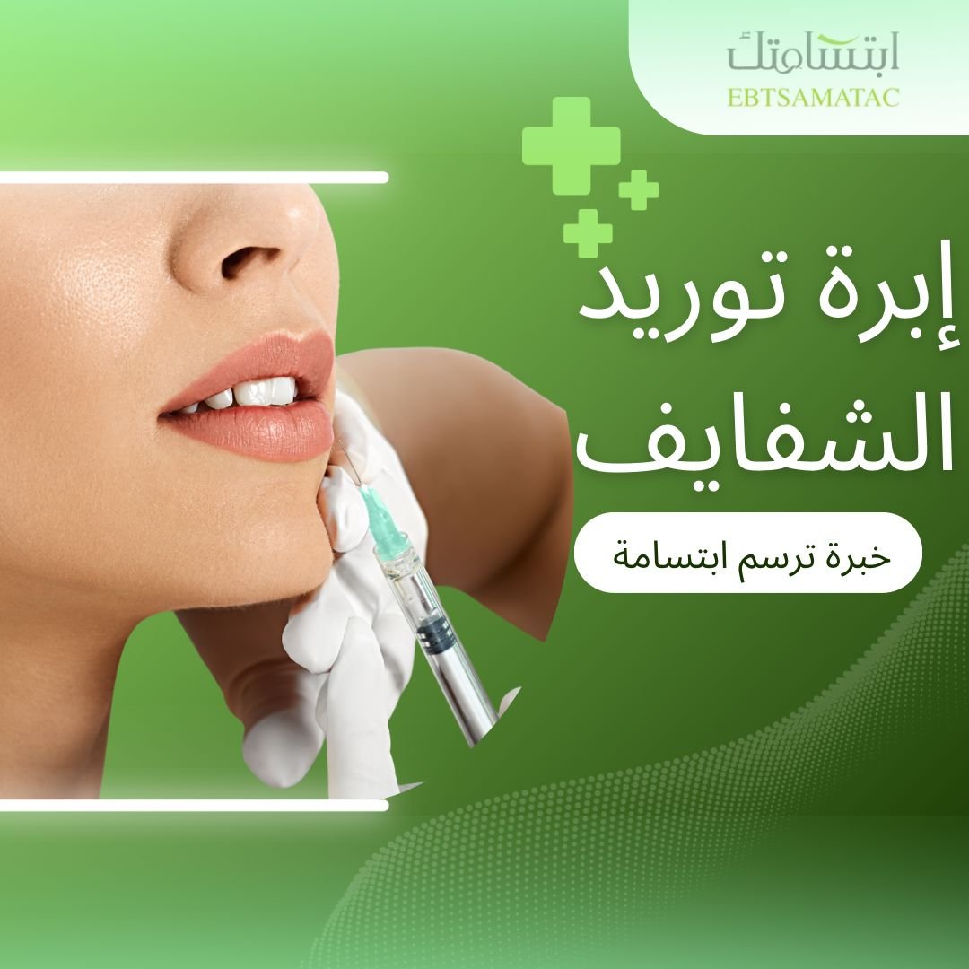 ابرة توريد الشفايف