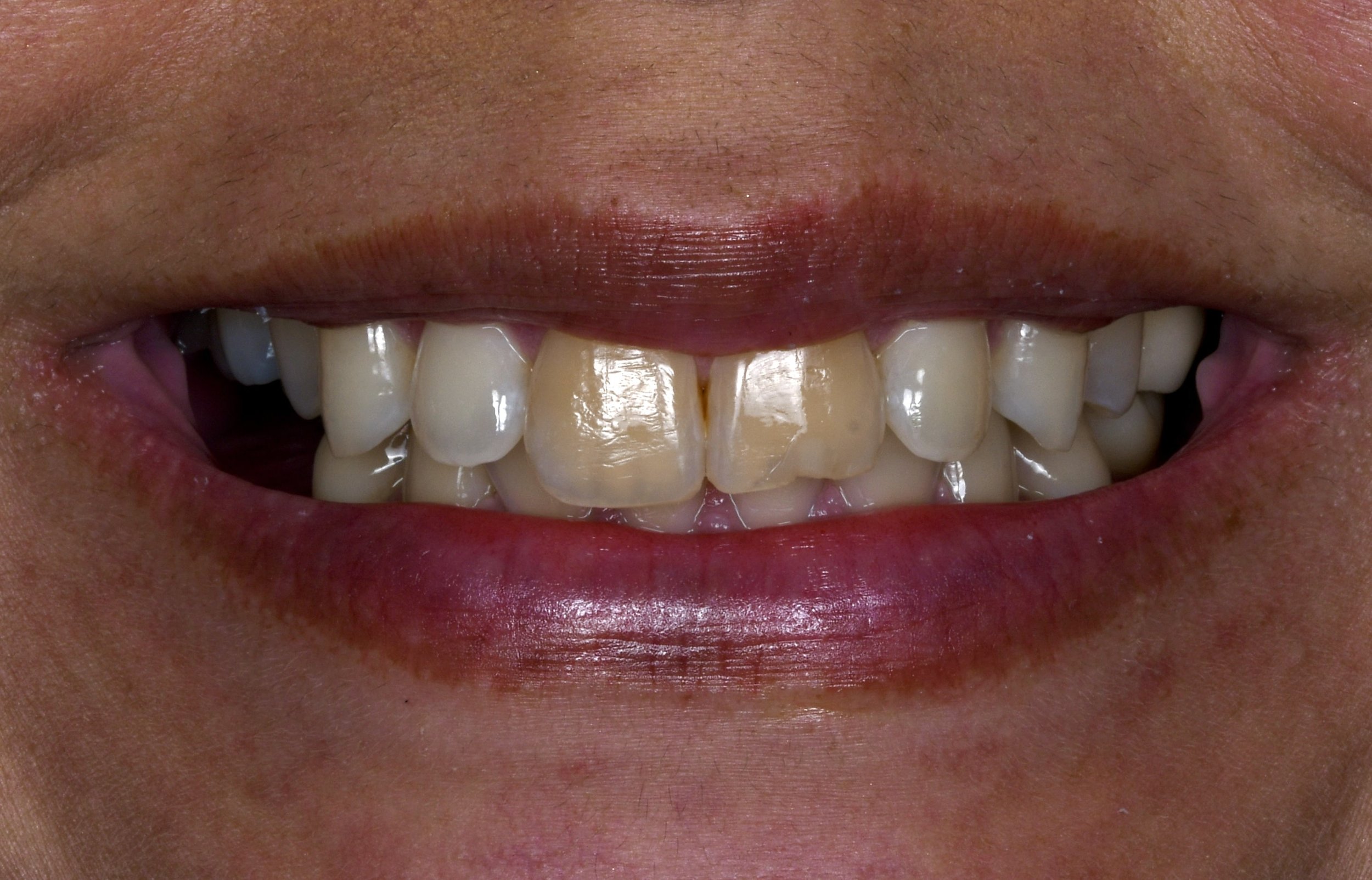 After