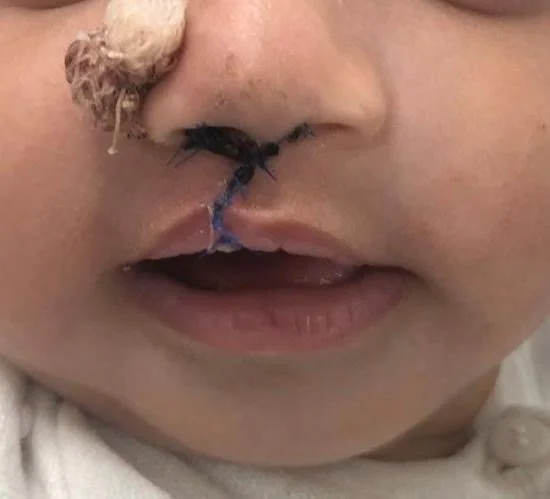 Paediatric Congenital Anomalies