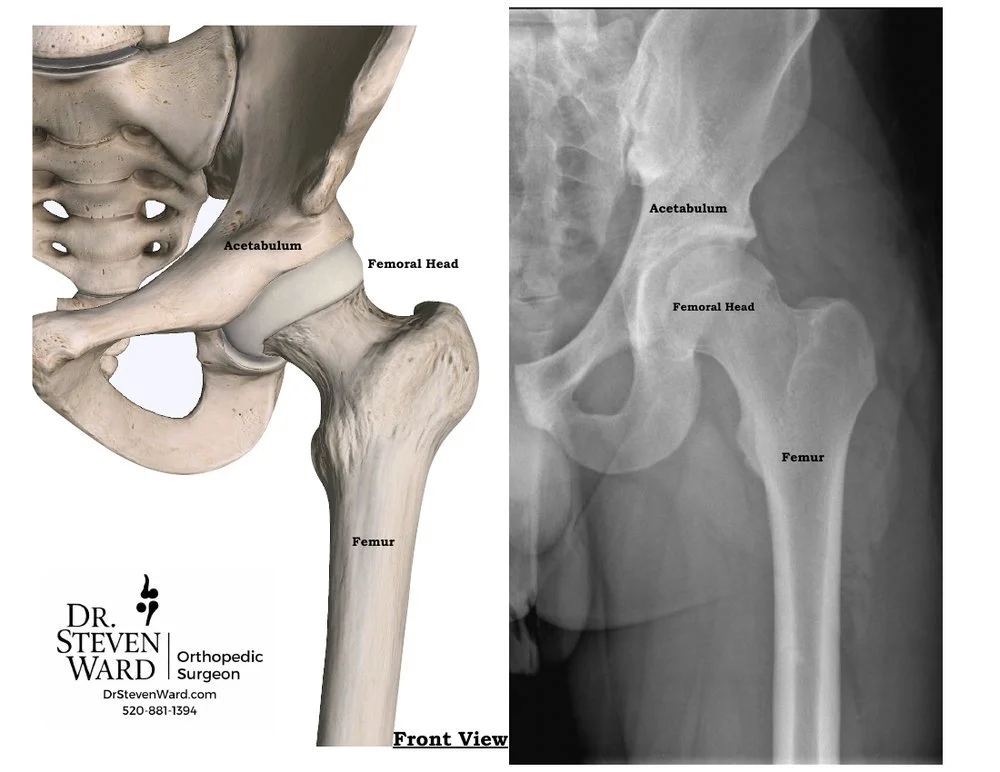 Front view of hip anatomy from the patient packet