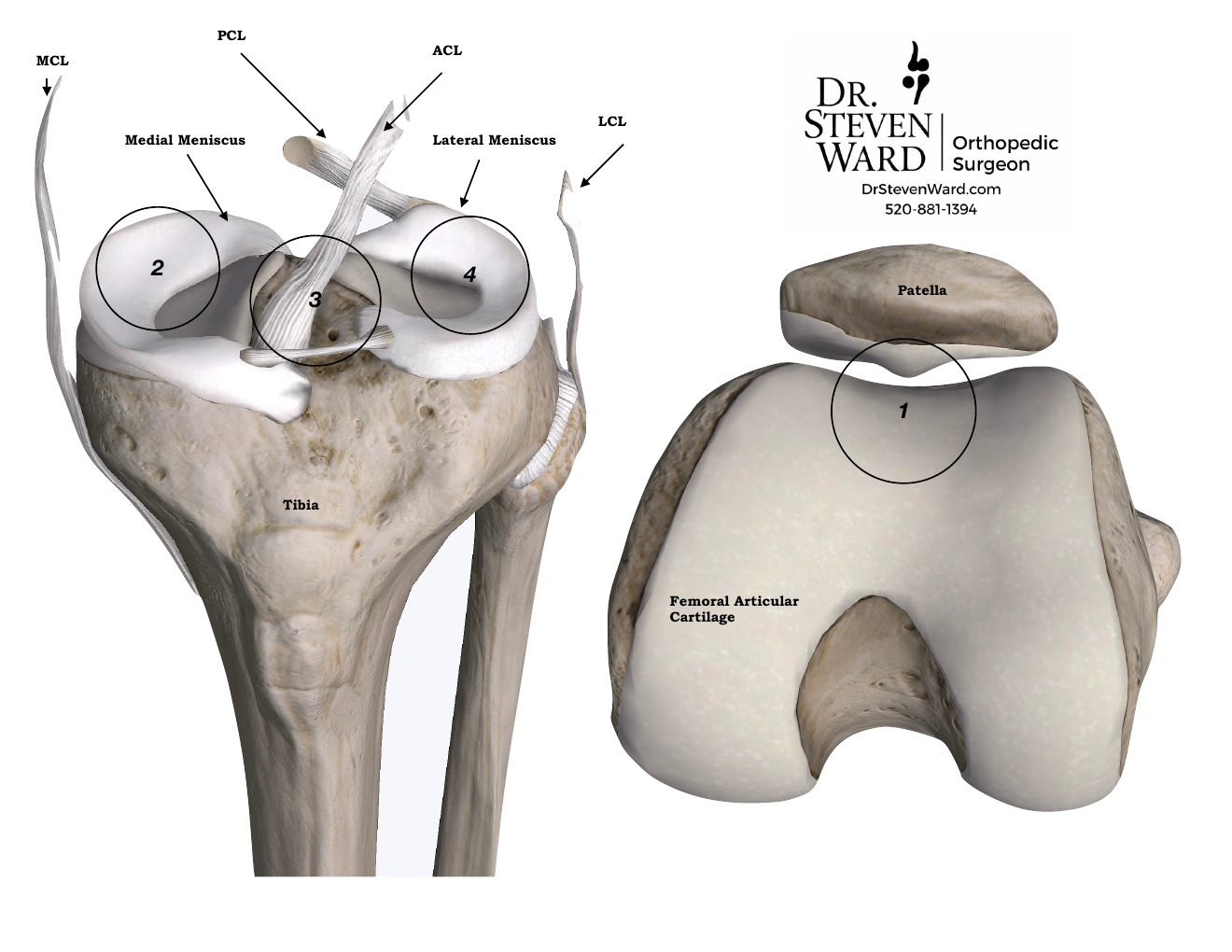 Labeled knee anatomy showing menisci, ACL, PCL, and numbered landmarks