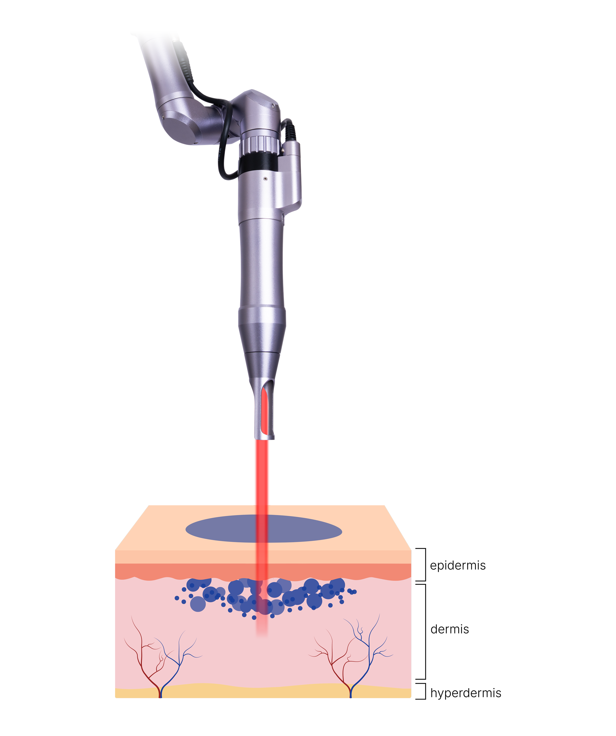 Pigment Breaking Down
