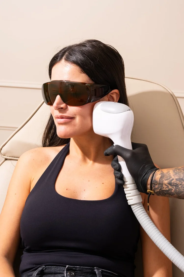 Laser hair removal on the face at Skyn Lab