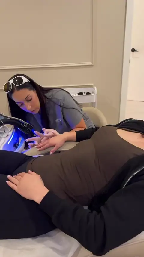 Laser tattoo removal on a finger tattoo at Skyn Lab