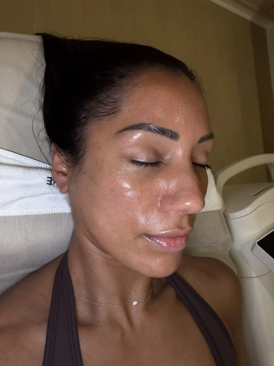 Client skin after a skin treatment at Skyn Lab Keilor East