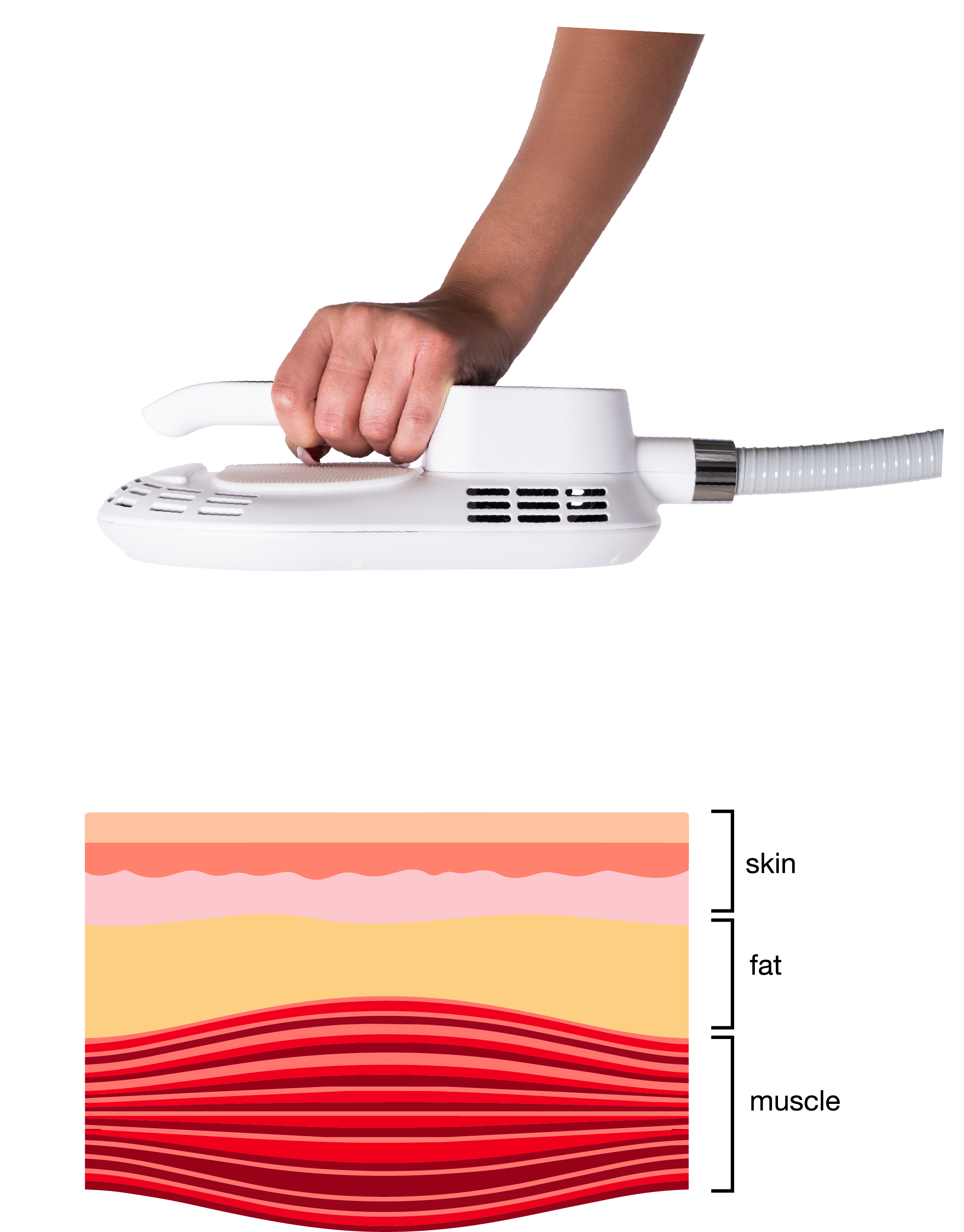 Skyn Sculpt device