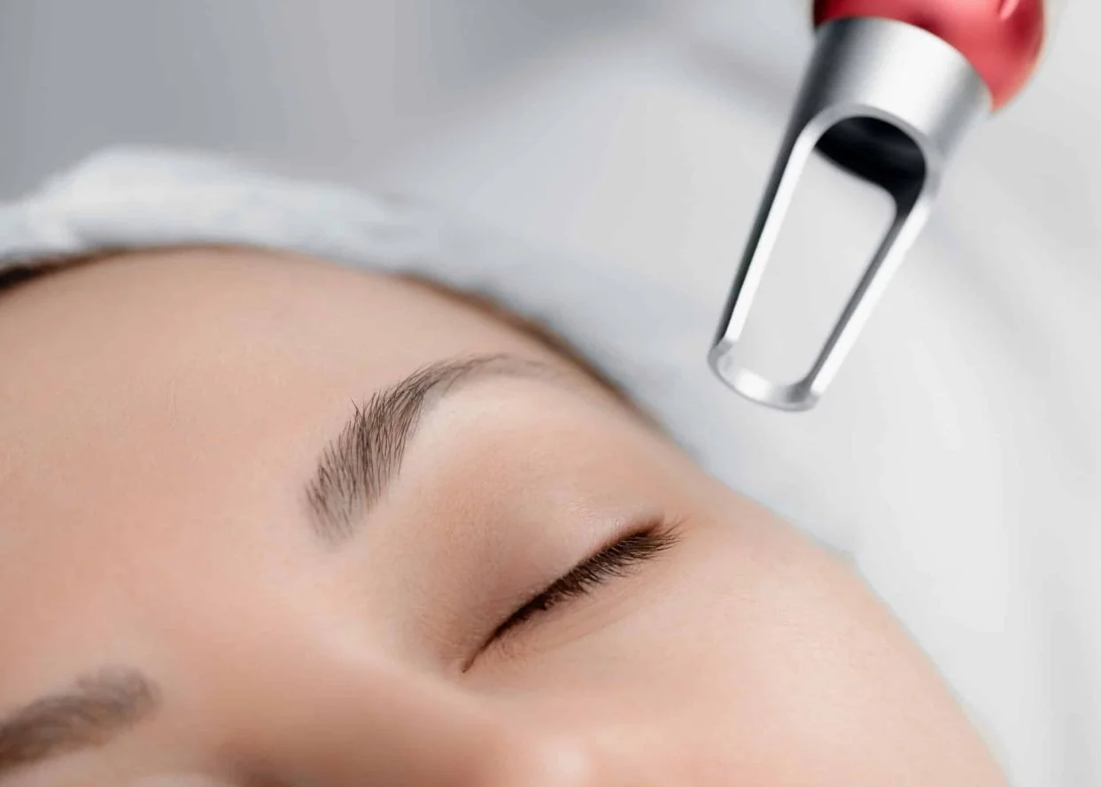 Double Eyelid Surgery