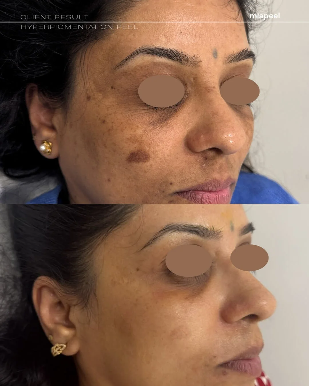 Before and after — face