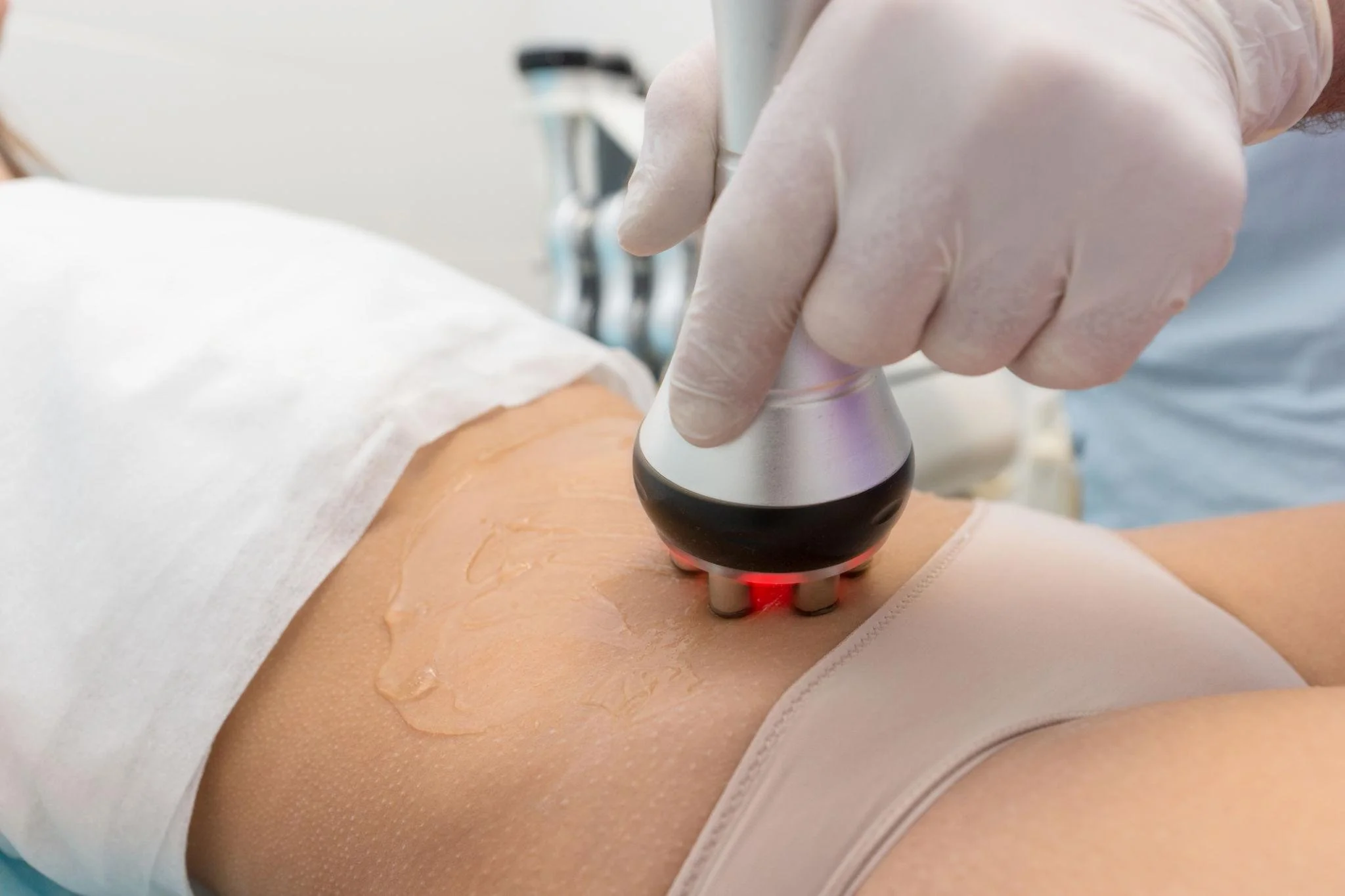 Body skin tightening treatment options in Canberra