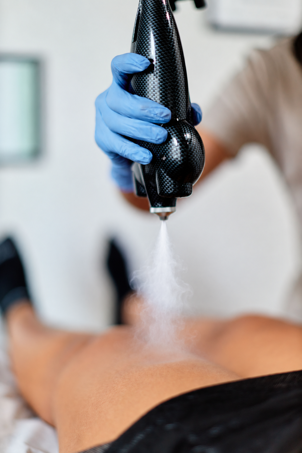 Targeted cryotherapy mist reaching the skin during a treatment