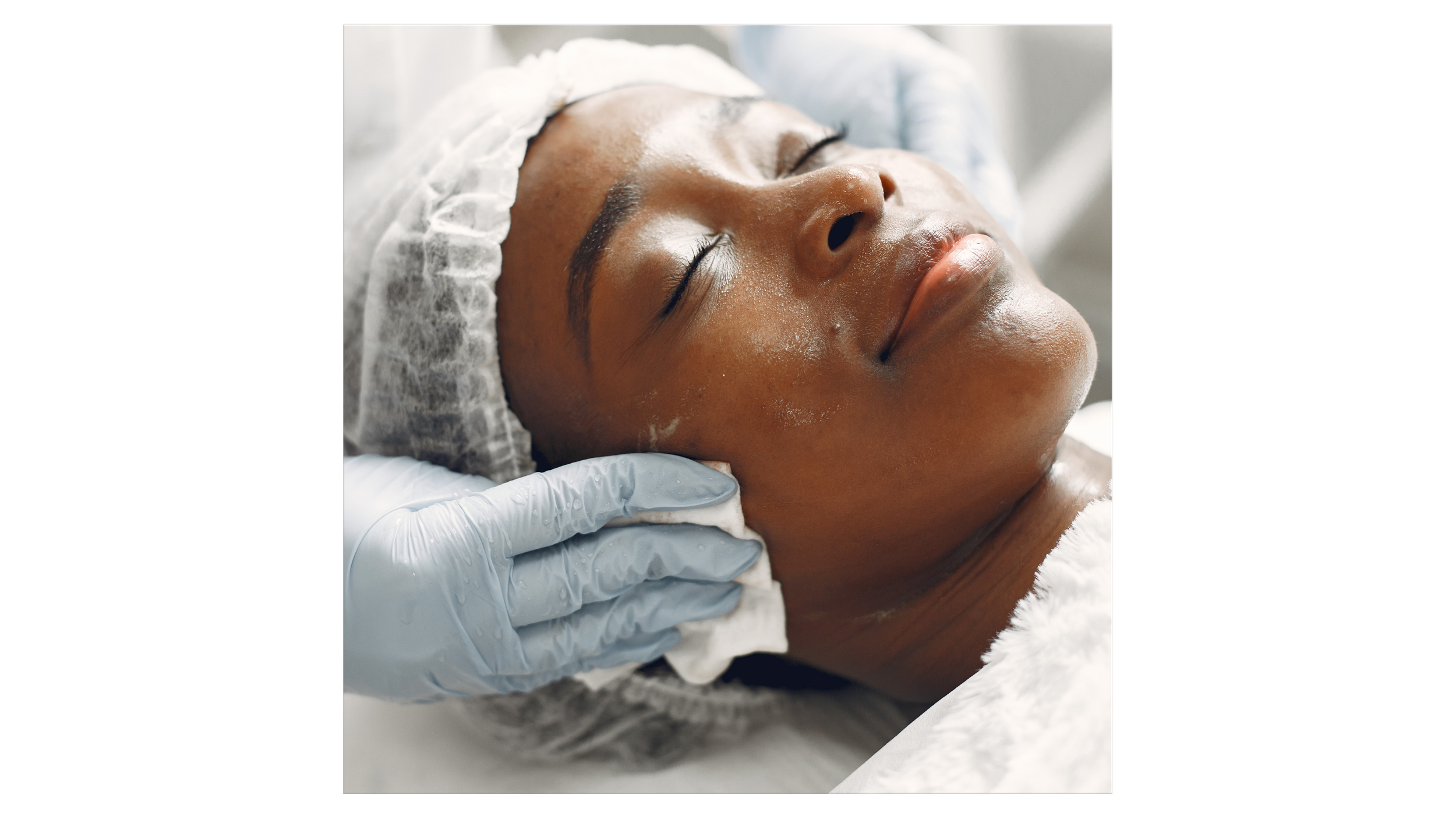 Anti-aging facial for mature skin