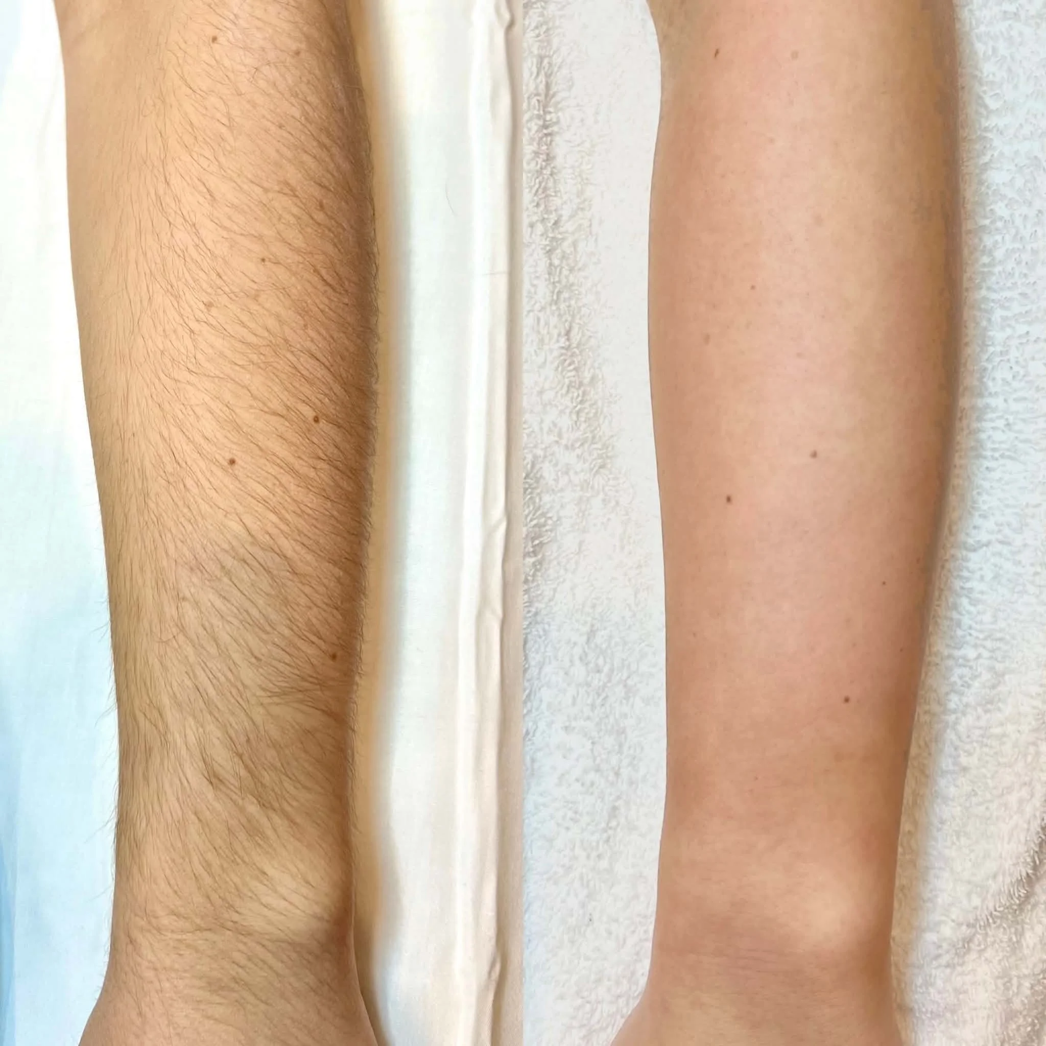 Waxing services at Solace Skin Studio