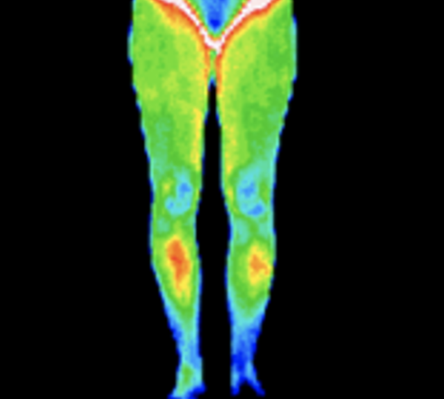 Thermography image of legs