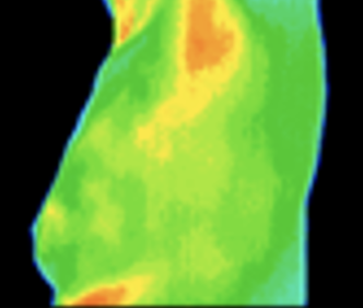 Thermography image of breast, side view