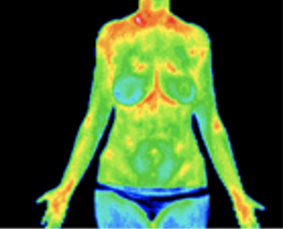 Full frontal thermography image