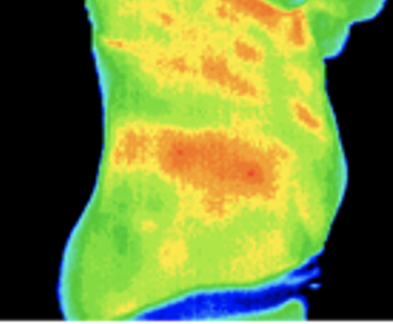 Thermography image of abdomen, lateral view