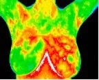 Fibrocystic Scan