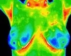 Normal Scan