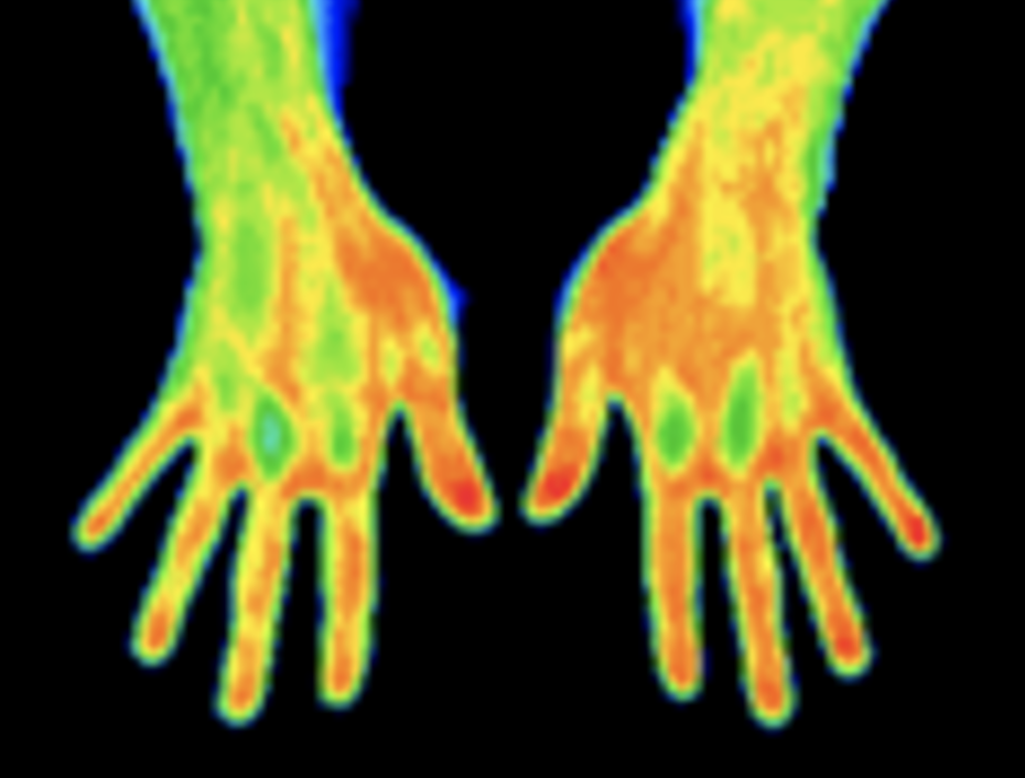 Thermography image of hands
